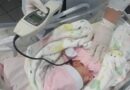 Dia Mundial da Audição: diagnóstico precoce garante desenvolvimento auditivo de bebês no Hospital Edson Ramalho